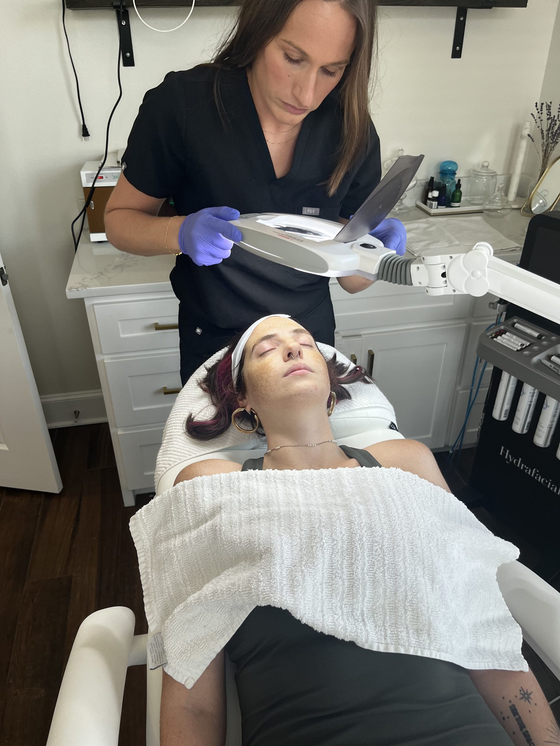 chemical peels
