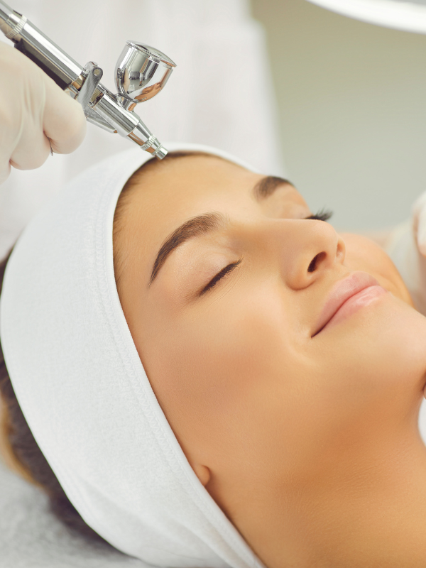 light chemical peel