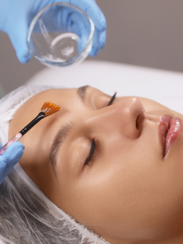 advanced chemical peel